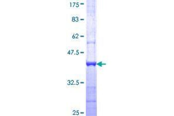 CATSPER3 Protein (AA 299-398) (GST tag)