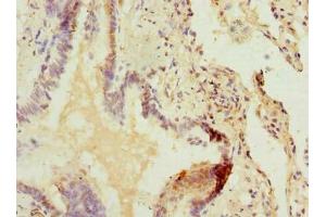 Immunohistochemistry of paraffin-embedded human lung tissue using ABIN7162554 at dilution of 1:100 (ZDHHC5 抗体  (AA 231-500))