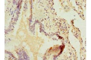 Immunohistochemistry of paraffin-embedded human lung tissue using ABIN7162554 at dilution of 1:100