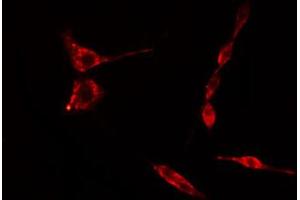 ABIN6274749 staining Hela cells by IF/ICC. (RPS15 抗体  (C-Term))