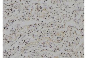 ABIN6278345 at 1/100 staining Human lung tissue by IHC-P. (RECQL2 抗体  (Internal Region))