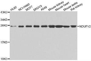 Western blot analysis of extracts of various cell lines, using NDUFV2 antibody. (NDUFV2 抗体  (AA 1-249))