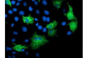 Anti-KATNB1 mouse monoclonal antibody (ABIN2455185) immunofluorescent staining of COS7 cells transiently transfected by pCMV6-ENTRY KATNB1 (RC201852). (KATNB1 抗体)