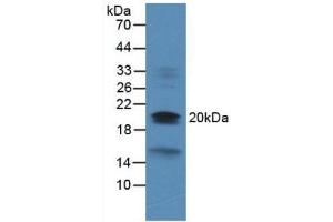 Western blot analysis of Rat Heart Tissue. (Dual Specificity Phosphatase 3 (DUSP3) (AA 2-185) 抗体)