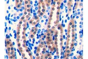 Detection of FGF1 in Mouse Kidney Tissue using Polyclonal Antibody to Fibroblast Growth Factor 1, Acidic (FGF1) (FGF1 抗体  (AA 16-155))