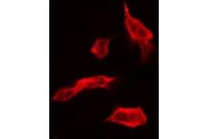 Immunofluorescence (fixed cells) (IF/ICC) image for anti-Protein Phosphatase 1, Regulatory (Inhibitor) Subunit 14A (PPP1R14A) (pThr38) antibody (ABIN6256551)