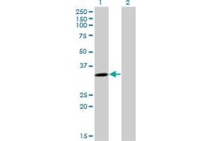 Western Blot analysis of SULT4A1 expression in transfected 293T cell line by SULT4A1 monoclonal antibody (M02), clone 3C1. (SULT4A1 抗体  (AA 1-100))