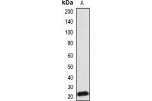 Western blot analysis of IL-18 expression in Hela (A) whole cell lysates. (IL-18 抗体)