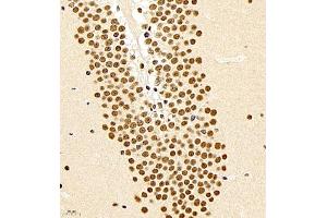 Immunohistochemistry of paraffin embedded mouse brain using smad62024 (ABIN7075629) at dilution of 1:1000 (400x lens) (SMAD6 抗体)