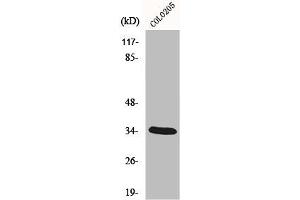 Western Blot analysis of COLO205 cells using MOX-2 Polyclonal Antibody (MEOX2 抗体  (Internal Region))