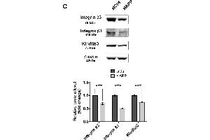 APP silencing affects HUVEC cell adhesion and focal adhesion organization and expression: Adhesion assay performed on collagen I (1 μg/mL) (A), and fibronectin (3 μg/mL) (B) coatings at different time-points (1 h, 