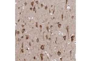 Immunohistochemical staining of human hippocampus with AADACL1 polyclonal antibody  shows strong cytoplasmic positivity in neuronal cells.