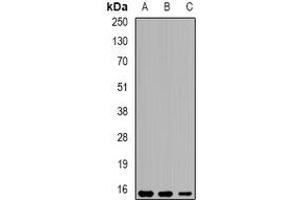 Western blot analysis of Eppin expression in THP1 (A), mouse liver (B), mouse testis (C) whole cell lysates. (Eppin 抗体)