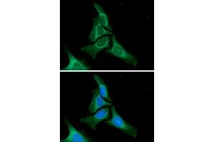 ICC/IF analysis of Calnexin in HeLa cells.