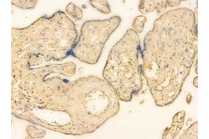 ABIN6262161 and ABIN6266557 at 1/100 staining human normal placenta tissue by IHC-P. (HCG beta 抗体)