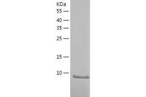 Western Blotting (WB) image for Secretoglobin, Family 1D, Member 1 (SCGB1D1) (AA 22-90) protein (His tag) (ABIN7125004)