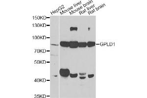 Western blot analysis of extracts of various cell lines, using GPLD1 antibody (ABIN2562895) at 1:1000 dilution. (GPLD1 抗体)