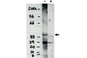 Image no. 1 for anti-Sphingosine-1-Phosphate Receptor 4 (S1PR4) (C-Term) antibody (ABIN201606) (S1PR4 抗体  (C-Term))