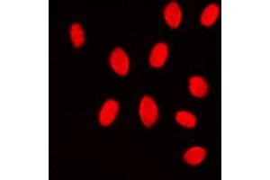 Immunofluorescent analysis of MKK3/6 staining in Jurkat cells. (MKK3/6 (Center) 抗体)