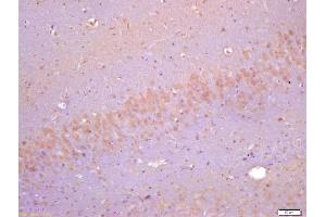 Formalin-fixed and paraffin embedded rat brain labeled with Anti-Cyclin F Polyclonal Antibody, Unconjugated (ABIN732968) at 1:200 followed by conjugation to the secondary antibody and DAB staining (Cyclin F 抗体  (AA 451-550))