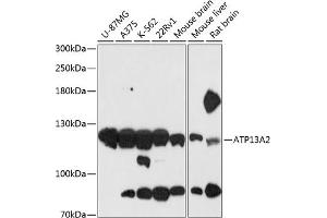 Western blot analysis of extracts of various cell lines, using  antibody (ABIN6127385, ABIN6137296, ABIN6137297 and ABIN6216941) at 1:3000 dilution. (ATP13A2 抗体  (AA 67-210))