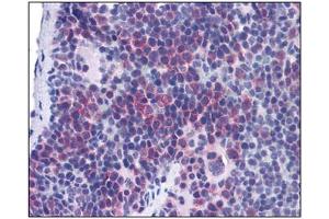 Image no. 1 for anti-T-Cell Immunoglobulin and Mucin Domain Containing 4 (TIMD4) (Center) antibody (ABIN302874) (TIMD4 抗体  (Center))