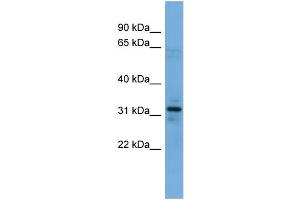 WB Suggested Anti-MYOZ1 Antibody Titration: 0. (Myozenin 1 抗体  (N-Term))
