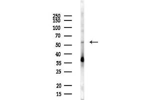 anti-UBX Domain Protein 7 (UBXN7) antibody