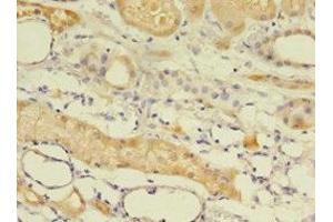 Immunohistochemistry of paraffin-embedded human kidney tissue using ABIN7145562 at dilution of 1:100 (EPHX2 抗体  (AA 1-555))