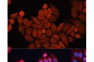 Immunofluorescence analysis of HeLa cells using DNAJB1 Polyclonal Antibody at dilution of 1:100. (DNAJB1 抗体)