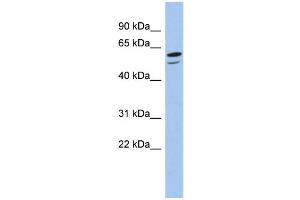 WB Suggested Anti-ZNF248 Antibody Titration:  0. (ZNF248 抗体  (N-Term))