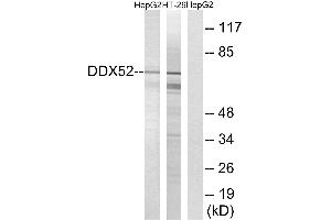 Western blot analysis of extracts from HepG2 cells and HT-29 cells, using DDX52 antibody.