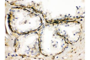 Immunohistochemistry (Paraffin-embedded Sections) (IHC (p)) image for anti-Transient Receptor Potential Cation Channel, Subfamily M, Member 5 (TRPM5) (AA 1021-1108) antibody (ABIN3044566)