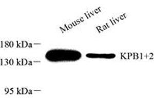 Western blot analysis of KPB1+2 (ABIN7074443) at dilution of 1: 2000,Lane 1: Mouse liver tissue lysate,Lane 2: Rat liver tissue lysate (KPB1/2 抗体)