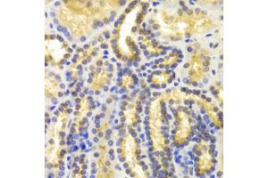 Immunohistochemistry of paraffin-embedded human kidney using EIF5A antibody (ABIN5971052) at dilution of 1/100 (40x lens). (EIF5A 抗体)
