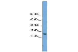 PAGE4 antibody used at 1 ug/ml to detect target protein. (PAGE4 抗体)