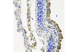 Immunohistochemistry of paraffin-embedded mouse lung using MARK1 antibody (ABIN5974592) at dilution of 1/100 (40x lens). (MARK1 抗体)