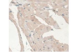 DAB staining on IHC-P Samples:Rat Heart Tissue (Androgen Receptor 抗体  (AA 491-679))