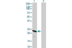 Western Blot analysis of HSPB8 expression in transfected 293T cell line by HSPB8 monoclonal antibody (M04), clone 5B12. (HSPB8 抗体  (AA 97-196))