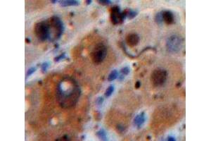 IHC-P analysis of Liver tissue, with DAB staining. (CSF3R 抗体  (AA 271-428))