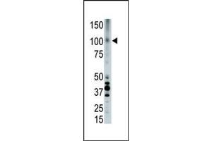 The anti-LRP8 Pab (ABIN390101 and ABIN2840613) is used in Western blot to detect LRP8 in placenta cell lysate. (LRP8 抗体  (C-Term))
