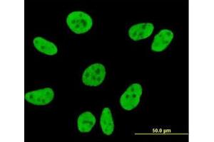 Image no. 3 for anti-Coiled-Coil Domain Containing 132 (CCDC132) (AA 862-965) antibody (ABIN961368) (Syndetin/VPS50 抗体  (AA 862-965))