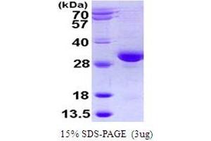 RAB32, Member RAS Oncogene Family (RAB32) (AA 1-225) protein (His tag)