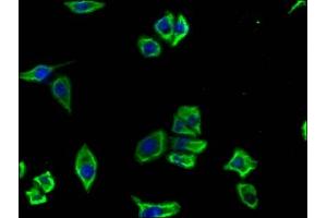Immunofluorescence (IF) image for anti-CD19 Molecule (CD19) (AA 20-291) antibody (ABIN7147133)