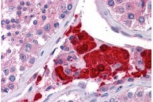 Human Testis: Formalin-Fixed, Paraffin-Embedded (FFPE) (TTC1 抗体  (AA 193-293))