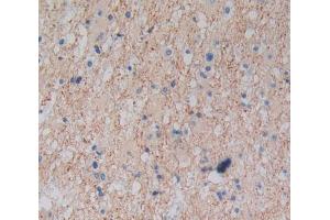 Used in DAB staining on fromalin fixed paraffin- embedded glioma tissue (Plexin A1 抗体  (AA 43-300))