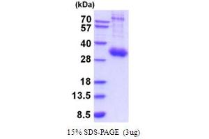 SDS-PAGE (SDS) image for Interleukin 10 Receptor, alpha (IL10RA) (AA 22-235) protein (His tag) (ABIN5854217) (IL-10RA Protein (AA 22-235) (His tag))