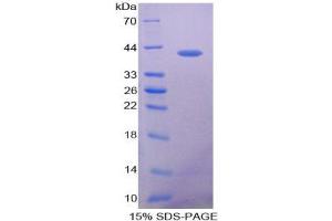 SDS-PAGE analysis of Human VCC1 Protein. (CXCL17 蛋白)