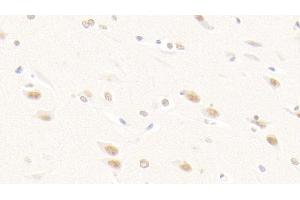 Detection of FGF2 in Human Cerebrum Tissue using Polyclonal Antibody to Fibroblast Growth Factor 2, Basic (FGF2) (FGF2 抗体  (AA 159-288))