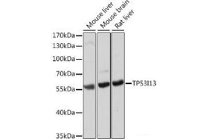Western blot analysis of extracts of various cell lines using TP53I13 Polyclonal Antibody at dilution of 1:1000. (TP53I13 抗体)